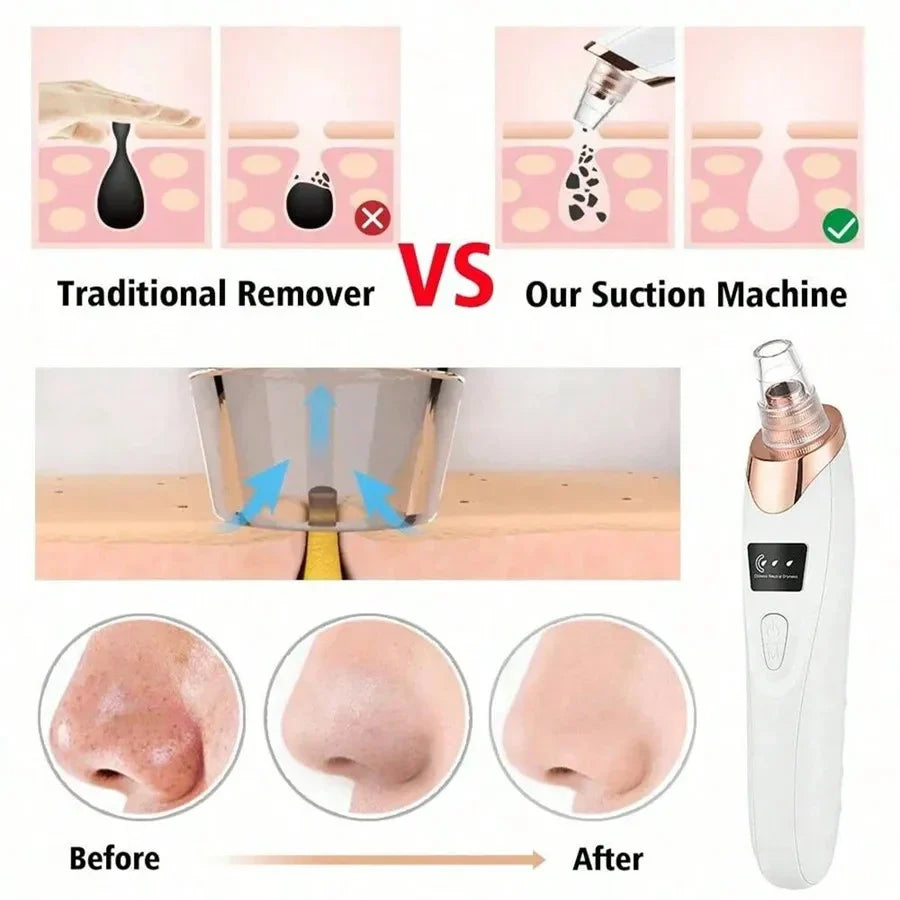 Electric Blackhead Remover Vacuum Cleaner - Facial Deep Cleansing Pore Cleaner