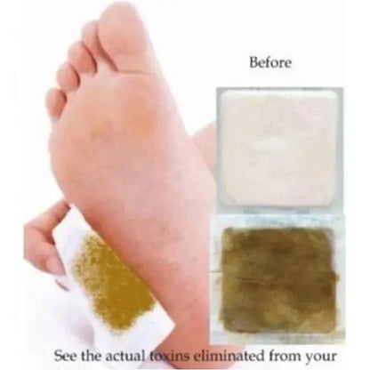 Kinoki Cleansing Detox Leg Healthy Herbal Pads 10pcs Hommart