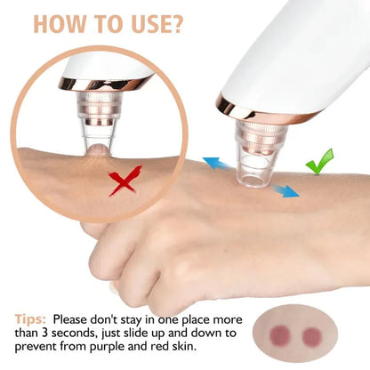 Rechargeable Blackhead Pore Remover