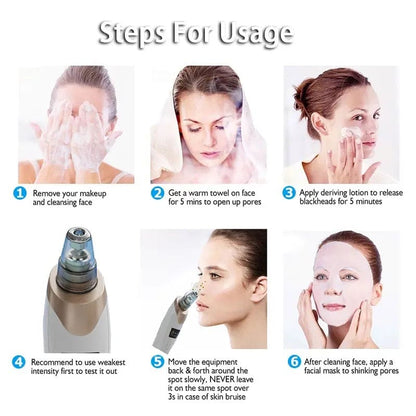 Rechargeable Blackhead Pore Remover