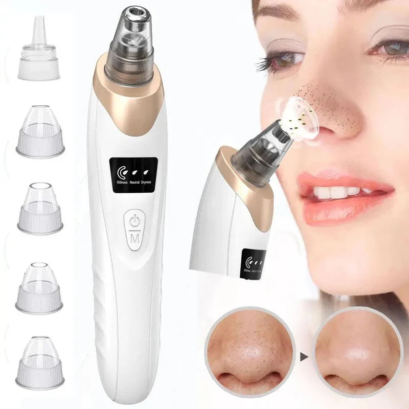 Rechargeable Blackhead Pore Remover